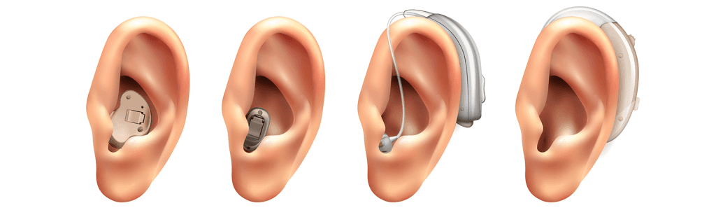 Compare hearing aid prices in India